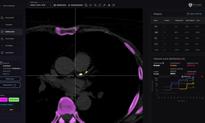 Polska platforma radiologiczna przesyła dane diagnostyczne tak sprawnie, jak serwisy stream