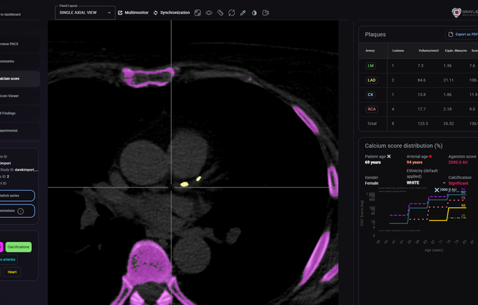 Polska platforma radiologiczna przesyła dane diagnostyczne tak sprawnie, jak serwisy stream