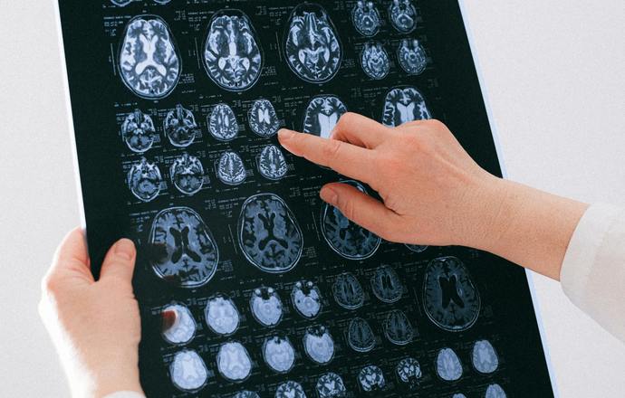 Innowacyjne podejście do diagnostyki oraz terapie chorób mózgu ratują życie i poprawiają je