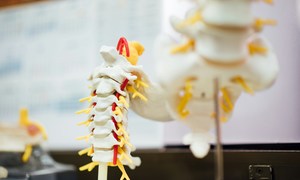 Od rusztowania do ruchu – jak druk 3D wspiera odbudowę rdzenia kręgowego?