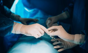 CRISPR-Cas9 i ksenotransplantacja jako nowe perspektywy w transplantologii płuc