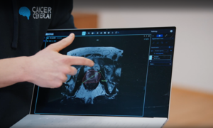 Polski start-up usprawnia diagnostykę onkologiczną – sztuczna inteligencja w laboratoriach