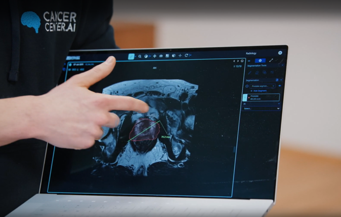 Polski start-up usprawnia diagnostykę onkologiczną – sztuczna inteligencja w laboratoriach