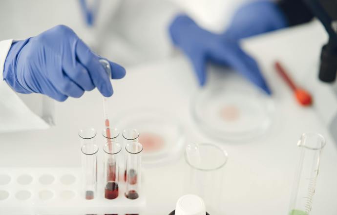 Nowo opracowany suplement żelaza z dodatkiem probiotyków i prebiotyków łagodny dla układu p