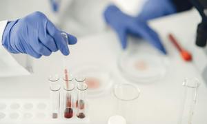 Nowo opracowany suplement żelaza z dodatkiem probiotyków i prebiotyków łagodny dla układu p