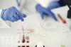Nowo opracowany suplement żelaza z dodatkiem probiotyków i prebiotyków łagodny dla układu p