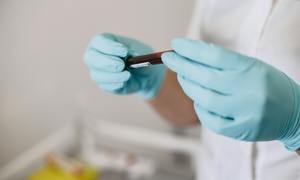 Pierwsze w Polsce zastosowanie leku w terapii obniżającej poziom złego cholesterolu
