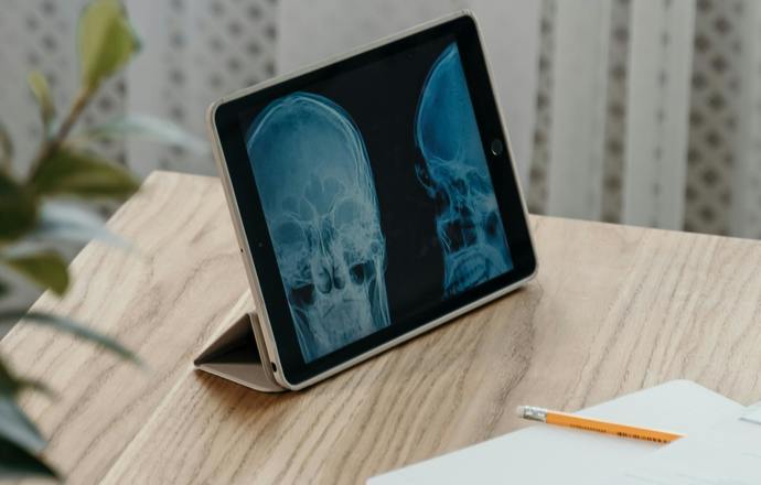 Plastyczność mózgu kluczem do terapii leczenia depresji, padaczki i uzależnień. Rusza nowy