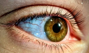 Elektroniczny implant przywraca zdolność czytania osobom z zaawansowaną atrofią siatkówki