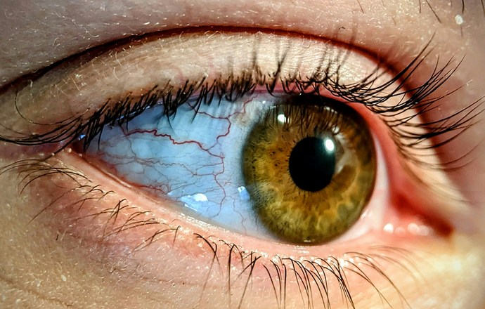 Elektroniczny implant przywraca zdolność czytania osobom z zaawansowaną atrofią siatkówki