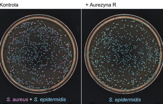 Celowana terapia antybakteryjna – nowa nadzieja dla pacjentów z atopowym zapaleniem skóry