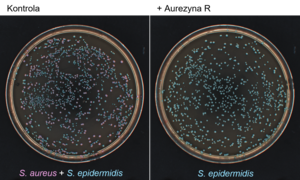Celowana terapia antybakteryjna – nowa nadzieja dla pacjentów z atopowym zapaleniem skóry