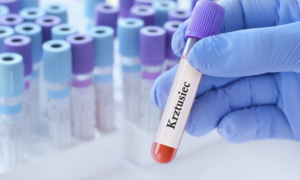 Immunologiczne przyczyny wzrostów zachorowań na krztusiec