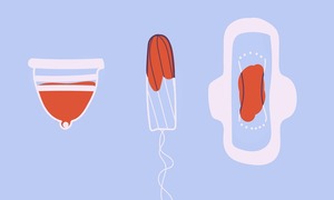 Neurostymulacja przezskórna jako metoda redukcji ciężkiego krwawienia menstruacyjnego