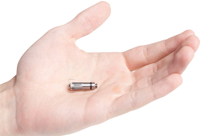 10 lat „kosmicznej” stymulacji bezelektrodowej w Polsce