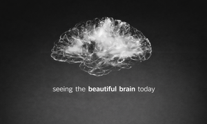 Neuroplastyczność i badania nad mózgiem w perspektywie wieku – przegląd postępów na tle med