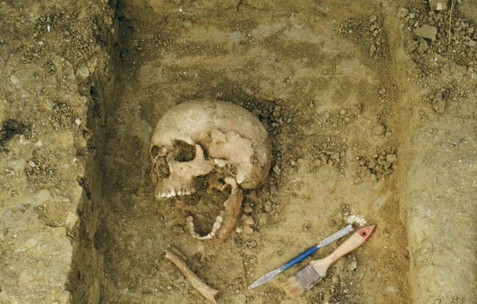 Ślady rekonstrukcji żuchwy u kobiety sprzed 2,5 tys. lat