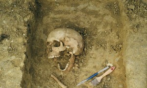 Ślady rekonstrukcji żuchwy u kobiety sprzed 2,5 tys. lat