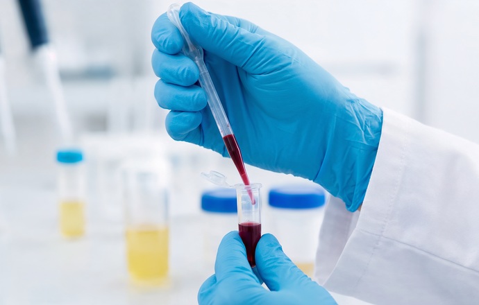 Terapie komórkowe zwiększają nadzieje, że szpiczak będzie możliwy do wyleczenia 