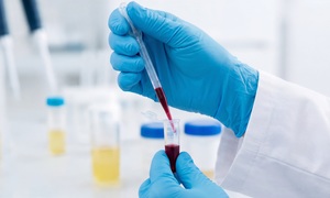 Terapie komórkowe zwiększają nadzieje, że szpiczak będzie możliwy do wyleczenia 