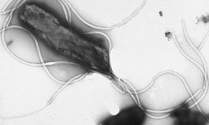 Jak wygrać z Helicobacter pylori? Wynalazek Polki może zmienić podejście do leczenia zakaże