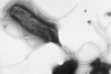 Jak wygrać z Helicobacter pylori? Wynalazek Polki może zmienić podejście do leczenia zakaże