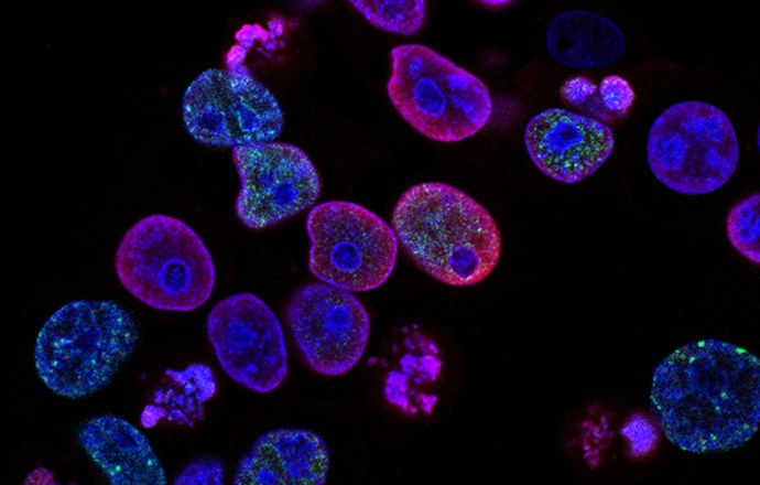 Nanosensory kwantowe, które mierzą temperaturę wewnątrz żywych komórek