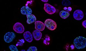 Nanosensory kwantowe, które mierzą temperaturę wewnątrz żywych komórek