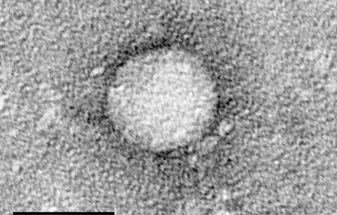 Nowa opcja terapeutyczna w zakażeniu HCV zatwierdzona