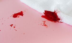Dorosłość z hemofilią A bez inhibitora – od wyzwań systemowych do rozwiązań