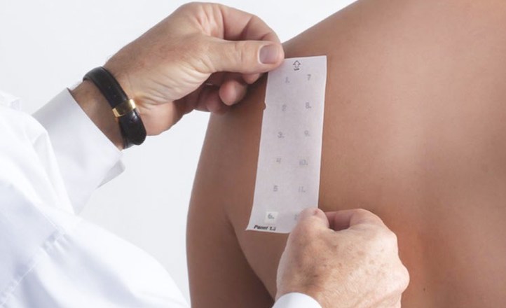 TRUE test w badaniach alergicznych skóry – na czym polega?