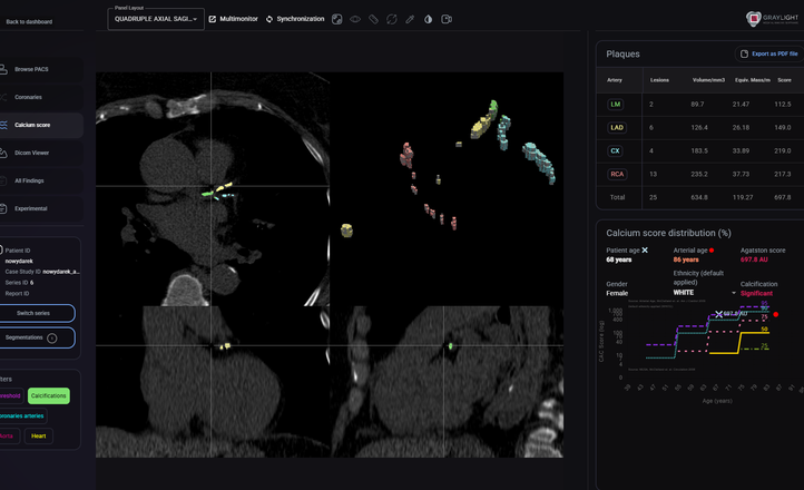 Polska platforma radiologiczna przesyła dane diagnostyczne tak sprawnie, jak serwisy stream