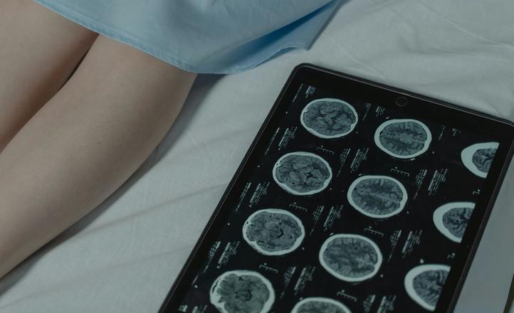 Prof. Sergiusz Nawrocki: „Mamy pierwszy lek na glejaka istotnie poprawiający rokowania chor