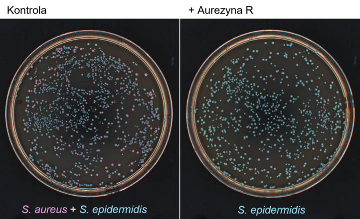 Celowana terapia antybakteryjna – nowa nadzieja dla pacjentów z atopowym zapaleniem skóry