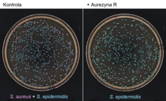 Celowana terapia antybakteryjna – nowa nadzieja dla pacjentów z atopowym zapaleniem skóry