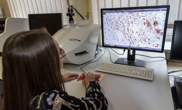 Krok w kierunku personalizowanego leczenia raka piersi postawiony we Wrocławiu