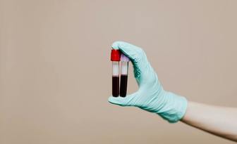 Hematolodzy: „Krew jest lekiem, którego będziemy potrzebować więcej, a którego nie da się w