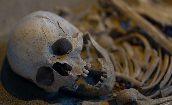 Ślady rekonstrukcji żuchwy u kobiety sprzed 2,5 tys. lat