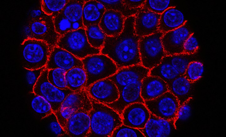Nanosensory kwantowe, które mierzą temperaturę wewnątrz żywych komórek