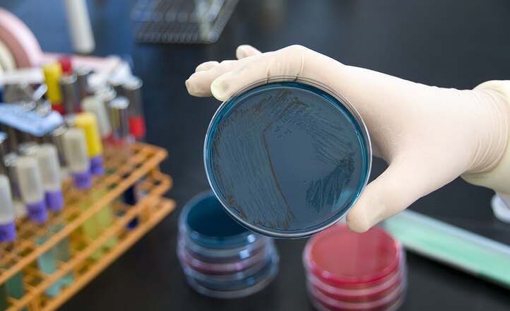 Polscy naukowcy zmodyfikowali probiotyk, który skuteczniej chronił przed zakażeniem Salmone