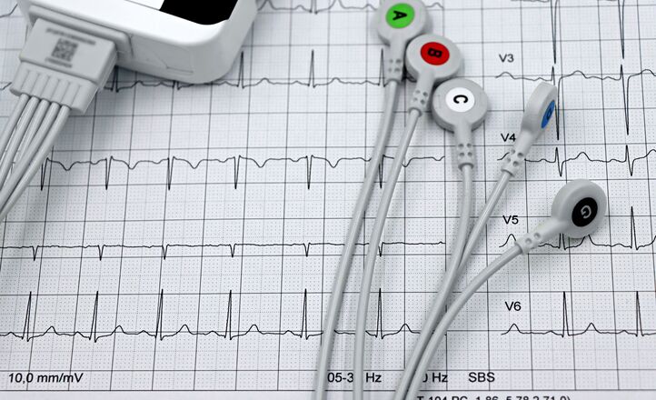 Kolorowa mapa EKG pokazuje rytm i kształt każdego uderzenia serca